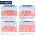 Medical Grade Silicone Scar Tape | Extra Long 59x1.5 Roll for Surgical C-Section Keloid & Tummy Tuck Scars | Reusable Scar Sheets - Buy Online on GoSupps.com