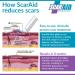 ScarAid Silicone Scar Gel Stick - Effective Scar Management Treatment 4.25g - Buy Online on GoSupps.com
