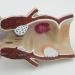 Human Rectal Hemorrhoid Lesions ical Model Colon Anal Sphincter Anorectal Teaching Specimen - Buy Online on GoSupps.com