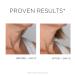IDC Dermo Profil D collet Cream - Vegan Anti-Aging Firming & Lifting Cream for Neck & D collet - 2.7 fl oz Breast Lift Peptide Complex - Buy Online on GoSupps.com