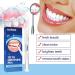 Teeth Whitening Pen - Pain-Free Tooth Bleaching Travel Size (5pc) | Quick & Gentle Tooth Whitening - Buy Online on GoSupps.com