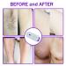 Silky Smooth Hair Eraser - Painless Hair Removal for Any Body Part in Blue - Buy Online on GoSupps.com