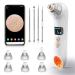 Hohotti Blackhead Remover Vacuum  Pimple Extractor Tools with Camera  Acne Comedone Popper Extractions Tool Kit  USB Rechargeable Pore Vacuum for Face 6 Suction Heads & 5 Modes Visual Blackhead Remover Vacuum