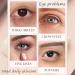 Retinol Eye Cream for Dark Circles and Puffiness Retinol Serum Under Eye Cream Stick Reducing Wrinkles and Fine Lines Moisturizing and Tightening Treatment Cream Smooth and Hydrate Skin - Buy Online on GoSupps.com