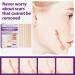 Professional Silicone Scar Removal Sheets - For Surgery, Burns, Keloids & Stretch Marks - Reusable & Clear Skin - One Size - Buy Online on GoSupps.com