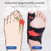 Entatial Bunion Corrector - 1pc Transpiration Hallux Valgus Corrector | Black SBR Foot Support for Comfort & Correction - Buy Online on GoSupps.com