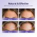 Silicone Forehead Wrinkle Patches - Reusable Non-Invasive Treatment for Overnight Anti-Wrinkle Care - Safe Facial Patches (4 Pack - Buy Online on GoSupps.com