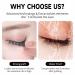 Buy 5ML Sensitive Cluster Lash Glue - Fast Drying Waterproof Black Eyelash Extension Adhesive for DIY Lash Extensions - Buy Online on GoSupps.com