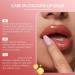 Moisturizing lip balm 5g nourishing and hydrating cream with long-lasting effect lip balm to repair cracked and flaky lips for women and girls - Buy Online on GoSupps.com