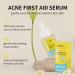 Skincare Set for Acne Prone Skin Anti Acne Skin Care Sets & Kits Skincare Gift Set with Cleanser- Serum- Essence Gel- Mask*2 Acne Remove Oil Control Facial Kit Hydrate Shrink Pore Sooth Redness - Buy Online on GoSupps.com