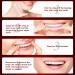 Teeth Whitening Strips - Professional Enamel-Safe Whitener | 28 Strips 14 Treatments | Non-Toxic Mint Flavor - Buy Online on GoSupps.com