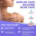 OK TAPE Silicone Scar Tape Roll - Professional Scar Removal Sheets for Surgical Scars - Reusable Silicone Strips for Keloid, C-Section, Tummy Tuck - 1.6 x70 Roll - Buy Online on GoSupps.com