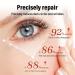 Retinol Eye Cream & 24k Under Eye Patches Kit - Anti-Aging Dark Circles & Puffy Eyes Treatment - Moisturizing & Firming Formula - Buy Online on GoSupps.com