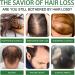 Rosemary Oil for Hair Growth Rosemary Hair Oil Rosemary Essential Oil for Hair Growth Wild Growth Hair Oil Improve Hair Loss and Nourishes Rosemary Scalp Oil for Women (60ML+2brush) - Buy Online on GoSupps.com
