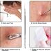 Pointed Blackhead Removal Tool - Stainless Steel 2-in-1 Acne Extractor for Face/Nose - Buy Online on GoSupps.com