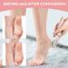 Nuve Smooth Pedicure Wand | Electric Callus Remover for Feet | Waterproof Portable Tool for Smooth Heels & Dead Skin Removal - Buy Online on GoSupps.com