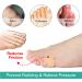 Welnove Gel Toe Separators - Small Toe Pillows & Sleeves for Friction Relief (8 Pack Beige) - International Shipping Available - Buy Online on GoSupps.com