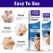 Effective Vitiligo Treatment Cream | Reduce Spots | Suitable for All Skin Types - Global Shipping - Buy Online on GoSupps.com