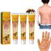 Bee Venom Psoriasis Treatment Cream New Zealand Bee Venom Professional Psoriasis Treatment Cream Soothing and Moisturizing Psoriasis Cream Psoriasis Treatment for Skin (Size : 3PCS)