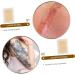 Homoyoyo Scar Concealing Tape Invisible Skin Cover Up Sticker For Scars Lightweight And Easy To Apply Natural Skin Tone - Buy Online on GoSupps.com