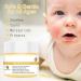 Soothing anti-itch cream 50 ml soothing skin lotion balm for itchy skin moisturizing care for sensitive areas daily use family application - Buy Online on GoSupps.com