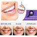 ZQTWJ v34 Color Correction Toothpaste - Purple Teeth Whitening Spot Removal Booster (1 Pc) for Bright Smiles - Buy Online on GoSupps.com