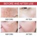 Trendyfave Dark Spot Serum Niacinamide Serum Brightening Serum 10% Niacinamide+ 4% Tranexamic Acid Dark Spot Corrector For Face Age Spot Remover For Face Face Redness Remover Arbutin Serum - Buy Online on GoSupps.com