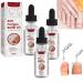 kerassentials for toenail fungus Anti Fungus Relief Oil Onychomycosis Nail Strong Nails (3pcs)