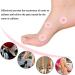 Large Round Corn Relief Pads - 15pcs Self Adhesive for Foot Care and Toe Protection - Buy Online on GoSupps.com