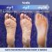 Scala Foot Peel Mask (2 Pack) - Dead Skin Remover for Dry Cracked Feet - Exfoliator Gel for Cracked Heels - Lavender Scented Treatment for Baby Soft Smooth Skin - Birthday Gift for Women - Buy Online on GoSupps.com