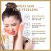Rice Toner Rice Water Toner for Face Hydrating Rice Face Toner Hydrating Toner for Face Natural Moisturizer Glow Essence Smoothing Toner for Face Deep Hydrating Moisturizing Essence Toner 150 ml - Buy Online on GoSupps.com