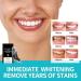 Professional Teeth Whitening Strips Kit - 14 Treatments for Sensitive Teeth - Mint Flavored 28 Dental Whitener Strips - Buy Online on GoSupps.com