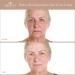 Project E Beauty Wireless Photon Skin Rejuvenation Mask - LED Light Therapy for Anti-Aging & Fold Removal | 7 Color Treatment for Face & Neck - Buy Online on GoSupps.com