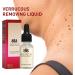 Aibyks 2 Skin Tag Corrector | Natural Mole Remover Cream Natural Skin Tag Removal Mole Corrector for Face Wart and Body Wart - Buy Online on GoSupps.com
