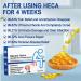 Diameleo Heca Herbal Hemorrhoid Capsules - Natural Relief & Rapid Treatment (8pcs) - Buy Online on GoSupps.com