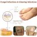 Anti Fungal Nail Treatment Device Anti Fungal Laser Nail Fungus Laser Treatment for Damaged Discolored Thick Toenails & Fingernails 7-Minute Home Treatment for Hand Toenail Fungal Infections - Buy Online on GoSupps.com
