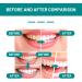 Furzero Smartsmile Oral Mouthwash - Teeth Whitening & Fresh Breath Care (3PCs) | Awzlove Total Care for Tooth & Gum Health - Buy Online on GoSupps.com
