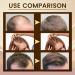 5% Biotin Minoxidil Hair Growth Oil 5% Minoxidil for Men and Women Hair Growth Serum Minoxidil Biotin Hair Growth Serum Nourishes Scalp Stops Hair Loss & Thinning 20ml (20ml) - Buy Online on GoSupps.com
