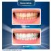 BetterWhite Professional Teeth Whitening Strips - 42 Peroxide-Free Strips - Enamel Safe Formula - 21 Treatments - Dentist Formulated Kit - Buy Online on GoSupps.com