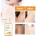 FAYNDE Turricum Body Cream 100ml - Nourishing Daily Skin Care with Ginger Extract for Women & Teens | Ideal for Back Neck Shoulders Arms & Legs - Buy Online on GoSupps.com