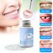 False Tooth Repair Kit with Thermal Fitting Beads - Snap On Instant Smile - Denture Adhesive - Buy Online on GoSupps.com