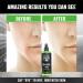 Viking Revolution Men's Facial Toner Spray - Hydrating and Balancing Skin Care for Men - 8oz - Buy Online on GoSupps.com