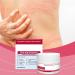 Anti-Itch Cream | Soothing and Calming Skin Care - Soothing Nourishing Lotion for Redness Gentle Hydration Night Care Swimming Travel Camping - Buy Online on GoSupps.com