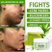 AILKE Salicylic Acid Acne Removal Cream - Control Breakouts Reduce Blemishes Unclog Pores - All Natural & Paraben Free - 1.76 Oz - Buy Online on GoSupps.com