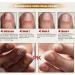 R paration des ongles | Renforcement des ongles pour ongles fins et croissance | Solution de r paration des ongles Renewal pour ongles d color s et ab m s Artiby - Buy Online on GoSupps.com
