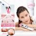 Pore Vacuum Facial Cleaner with 5 Suction Power Probes for Blackhead, Acne, and Whitehead Removal - Pink - Buy Online on GoSupps.com