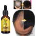 Sloane K-ing of Ginger Hair Growth 7 Days Hair Growth Hair Care Product Hair Serum Fast Hair Growth Accelerated Growth - Buy Online on GoSupps.com