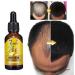 Pologmase Hair Growth Serum - Anti-Hair Loss Treatment for Stronger Thicker Longer Hair | 40ml - Buy Online on GoSupps.com