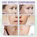 Hyaluronic Acid Serum for Face Face Serum Skincare for a Rejuvenated Skin - Collagen Serum for Face for Sensitive Skin - Buy Online on GoSupps.com