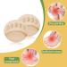 SooGree Ball of Foot Cushion Pads - Thicken Forefoot Metatarsal Cushion for Women Men - Pain Relief & Prevention - 5 Pairs Beige - Buy Online on GoSupps.com